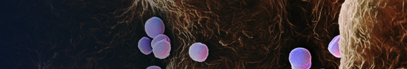 Staphylococcus aureus